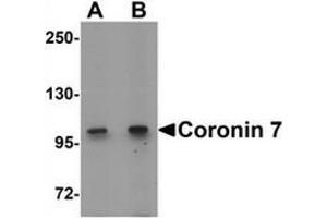 Coronin 7 抗体  (C-Term)