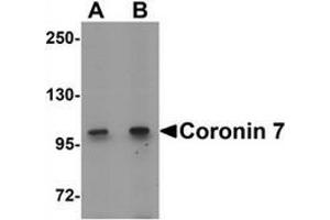 Western blot analysis of Coronin 7 in rat lung tissue lysate with Coronin 7 antibody at (A) 1 and (B) 2 ug/mL. (Coronin 7 抗体  (C-Term))
