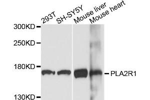 Western blot analysis of extracts of various cells, using PLA2R1 antibody. (PLA2R1 抗体)