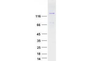 Western Blotting (WB) image for Membrane Associated Guanylate Kinase, WW and PDZ Domain Containing 3 (MAGI3) (Transcript Variant 2) protein (Myc-DYKDDDDK Tag) (ABIN2725817)