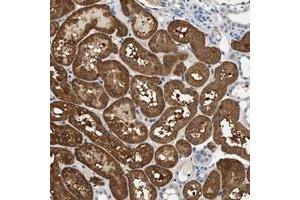 Immunohistochemical staining of human kidney with SLC35E1 polyclonal antibody  shows cytoplasmic positivity in renal tubules at 1:200-1:500 dilution.