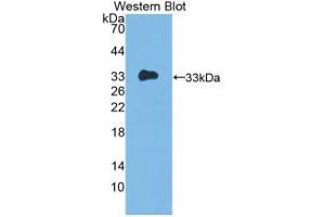 Western blot analysis of recombinant Human IL12A. (IL12A 抗体  (AA 23-219))