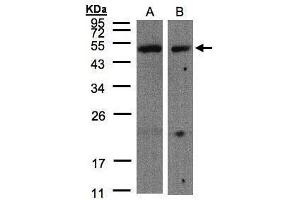 WB Image Sample(30 μg of whole cell lysate) A:A431, B:Hep G2, 10% SDS PAGE antibody diluted at 1:500 (CARD8 抗体  (C-Term))