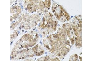 Immunohistochemistry of paraffin-embedded Human stomach using MARVELD2 Polyclonal Antibody (Tricellulin 抗体)