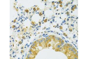 Immunohistochemistry of paraffin-embedded Mouse lung using SLC37A4 Polyclonal Antibody at dilution of 1:100 (40x lens). (SLC37A4 抗体)