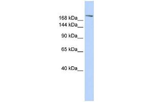 WB Suggested Anti-CCNB3 Antibody Titration:  0. (Cyclin B3 抗体  (C-Term))