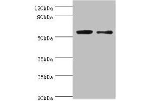 Western blot All lanes: PGD antibody at 2 μg/mL Lane 1: EC109 whole cell lysate Lane 2: 293T whole cell lysate Secondary Goat polyclonal to rabbit IgG at 1/15000 dilution Predicted band size: 54, 52 kDa Observed band size: 54 kDa (PGD 抗体  (AA 4-483))
