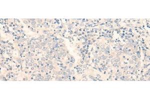 Immunohistochemistry (Paraffin-embedded Sections) (IHC (p)) image for anti-Egf-Like Module Containing, Mucin-Like, Hormone Receptor-Like 3 (EMR3) antibody (ABIN7248557)