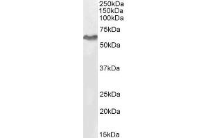 Western Blotting (WB) image for anti-Tripartite Motif Containing 55 (TRIM55) (C-Term) antibody (ABIN184953)