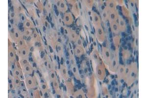 IHC-P analysis of Mouse Stomach Tissue, with DAB staining. (GREM1 抗体  (AA 25-184))