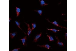 Immunofluorescence analysis of SCF antibody and HeLa cells. (KIT Ligand 抗体  (AA 244-273))