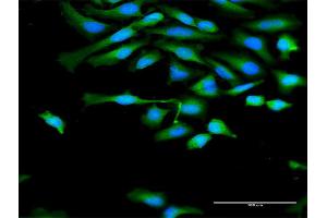 Immunofluorescence of purified MaxPab antibody to CAPN1 on HeLa cell. (CAPNL1 抗体  (AA 1-714))