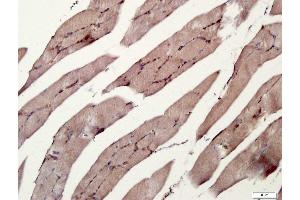 Paraformaldehyde-fixed, paraffin embedded rat skeletal muscle tissue, Antigen retrieval by boiling in sodium citrate buffer(pH6) for 15min, Block endogenous peroxidase by 3% hydrogen peroxide for 30 minutes, Blocking buffer (normal goat serum) at 37°C for 20min, Antibody incubation with Rabbit Anti-RANK Polyclonal Antibody, Unconjugated  at 1:400 overnight at 4°C, followed by a conjugated secondary and DAB staining (TNFRSF11A 抗体  (AA 101-200))