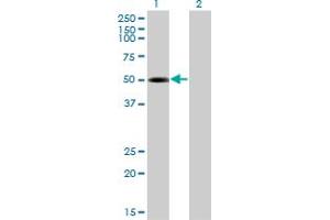 Western Blot analysis of TRIP6 expression in transfected 293T cell line by TRIP6 monoclonal antibody (M04), clone 4B7. (TRIP6 抗体  (AA 51-148))