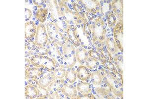 Immunohistochemistry of paraffin-embedded rat kidney using SIRT3 antibody (ABIN5974409) at dilution of 1/100 (40x lens). (SIRT3 抗体)