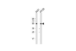 All lanes : Anti-p53 Antibody  at 1:2000 dilution Lane 1: A431 whole cell lysate Lane 2: HT-29 whole cell lysate Lysates/proteins at 20 μg per lane. (p53 抗体  (AA 293-322))