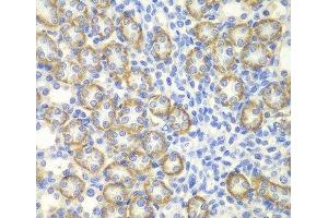 Immunohistochemistry of paraffin-embedded Rat kidney using SYT1 Polyclonal Antibody at dilution of 1:200 (40x lens). (SYT1 抗体)