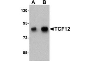 Western blot analysis of TCF12 in HeLa cell lysate with TCF12 antibody at (A) 0. (TCF12 抗体  (N-Term))