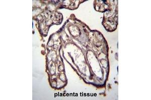 Immunohistochemistry (Paraffin-embedded Sections) (IHC (p)) image for anti-ADP-Ribosylation Factor Interacting Protein 1 (ARFIP1) (AA 114-144), (Middle Region) antibody (ABIN950480)