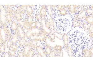 Detection of PLTP in Rat Kidney Tissue using Polyclonal Antibody to Phospholipid Transfer Protein (PLTP) (PLTP 抗体  (AA 337-479))