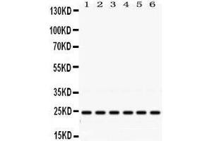 Western Blotting (WB) image for anti-RAB5A, Member RAS Oncogene Family (RAB5A) (AA 179-215), (C-Term) antibody (ABIN3043917) (RAB5 抗体  (C-Term))