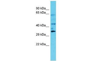 Host: Rabbit Target Name: C6orf106 Sample Type: Fetal Kidney lysates Antibody Dilution: 1. (C6orf106 抗体  (C-Term))