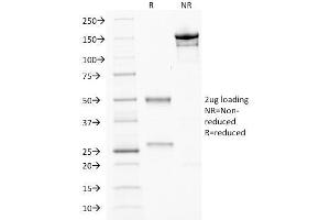 SDS-PAGE Analysis Purified CDX2 Mouse Monoclonal Antibody (CDX2/2214). (CDX2 抗体)
