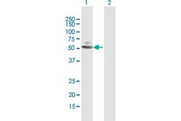 PARP15 antibody  (AA 1-444)