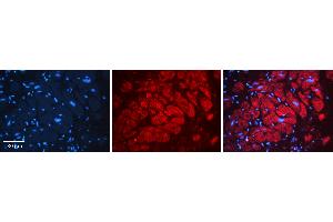Rabbit Anti-SEPT-9 Antibody Catalog Number: ARP51756_P050 Formalin Fixed Paraffin Embedded Tissue: Human heart Tissue Observed Staining: Cytoplasmic Primary Antibody Concentration: 1:100 Other Working Concentrations: N/A Secondary Antibody: Donkey anti-Rabbit-Cy3 Secondary Antibody Concentration: 1:200 Magnification: 20X Exposure Time: 0. (Septin 9 抗体  (Middle Region))