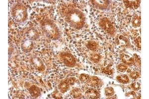 Immunohistochemistry (IHC) image for anti-ATP Synthase, H+ Transporting, Mitochondrial F1 Complex, alpha Subunit 1, Cardiac Muscle (ATP5A1) (C-Term) antibody (ABIN2855150)