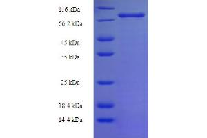 SDS-PAGE (SDS) image for X-Linked Inhibitor of Apoptosis (XIAP) (AA 1-497), (full length) protein (His-SUMO Tag) (ABIN5710630)