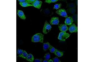 IF analysis of IDO1 using anti-IDO1 antibody (ABIN3043857).