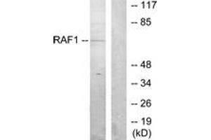 Western blot analysis of extracts from K562 cells, using C-RAF (Ab-259) Antibody. (RAF1 抗体  (AA 225-274))
