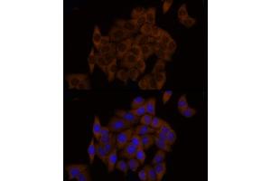 Immunofluorescence analysis of HeLa cells using GSDMD (Full Length+N terminal) Rabbit pAb (ABIN7267351) at dilution of 1:150 (40x lens). (GSDMD 抗体  (AA 154-252))