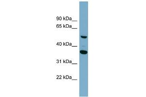 WB Suggested Anti-ADAMDEC1 Antibody Titration: 0. (ADAMDEC1 抗体  (Middle Region))