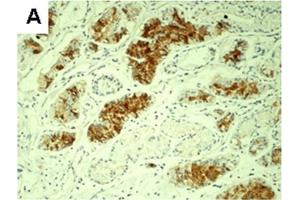 Expression of differentiated embryonic chondrocyte-expressed gene 1 (DEC1), hypoxia-inducible factor 1α (HIF-1α) and Ki67 protein in human gastric cancer tissue. (BHLHE40 抗体  (N-Term))
