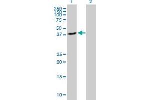 Western Blot analysis of QPCT expression in transfected 293T cell line by QPCT MaxPab polyclonal antibody. (QPCT 抗体  (AA 1-361))