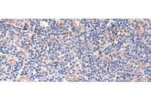 Immunohistochemistry of paraffin-embedded Human tonsil tissue using ZNF256 Polyclonal Antibody at dilution of 1:120(x200) (ZNF256 抗体)