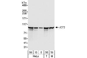 Western Blotting (WB) image for anti-Eukaryotic Translation Elongation Factor 2 (EEF2) (AA 808-858) antibody (ABIN7454538)