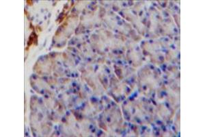 Used in DAB staining on fromalin fixed paraffin-embedded Pancreas tissue (IL9 Receptor 抗体  (AA 47-257))