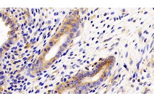 Detection of gp130 in Rat Uterus Tissue using Polyclonal Antibody to Glycoprotein 130 (gp130) (CD130/gp130 抗体  (AA 26-323))