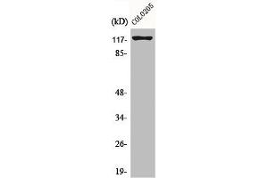 Western Blot analysis of COLO205 cells using Eg5 Polyclonal Antibody (KIF11 抗体)