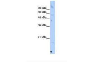 Image no. 1 for anti-Selenoprotein N, 1 (SEPN1) (C-Term) antibody (ABIN6738391) (SEPN1 抗体  (C-Term))