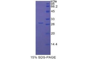 SDS-PAGE analysis of Rat LOXL1 Protein. (LOXL1 蛋白)