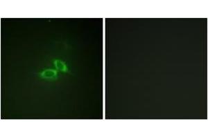 Immunofluorescence analysis of NIH-3T3 cells, using NMDAR1 (Ab-890) Antibody.