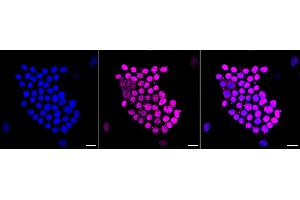 Immunocytochemical staining of Hela cells with DUT antibody (ABIN7798312), 1:1,000). (Recombinant Deoxyuridine Triphosphatase (DUT) 抗体)