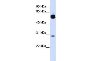 WB Suggested Anti-YWHAZ Antibody Titration:  0. (14-3-3 zeta 抗体  (Middle Region))