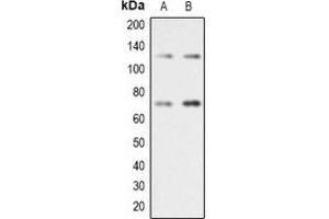 Western blot analysis of RAD21 expression in Jurkat (A), A431 (B) whole cell lysates. (RAD21 抗体  (C-Term))