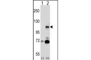 Western blot analysis of PIK3CB (arrow) using rabbit polyclonal PIK3CB Antibody (N-term ) (ABIN652426 and ABIN2842105). (PIK3CB 抗体  (N-Term))