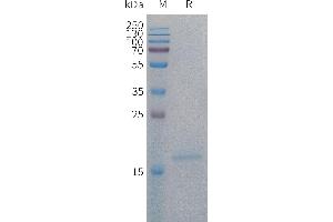 SDS-PAGE (SDS) image for Interleukin 4 (IL4) (AA 25-153) protein (His tag) (ABIN7491513)